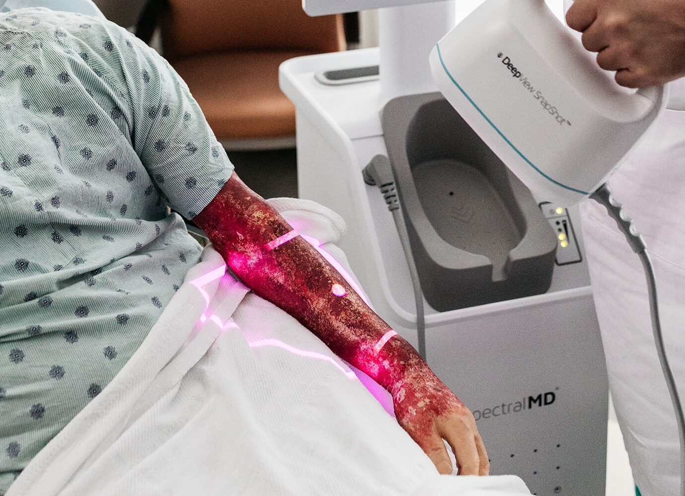clinical decision tools for burns and dfu