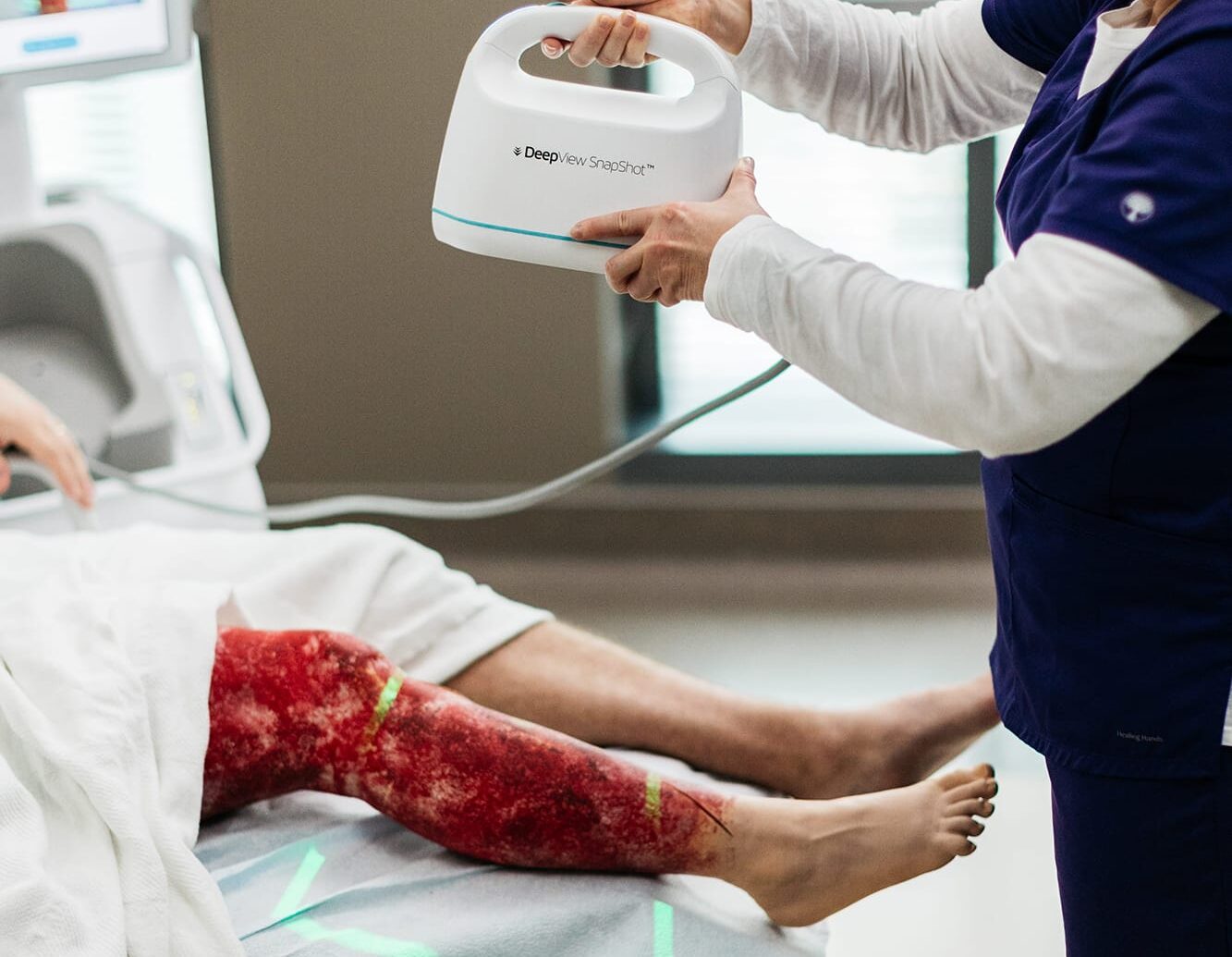 healthcare practitioner using DeepView on patient leg